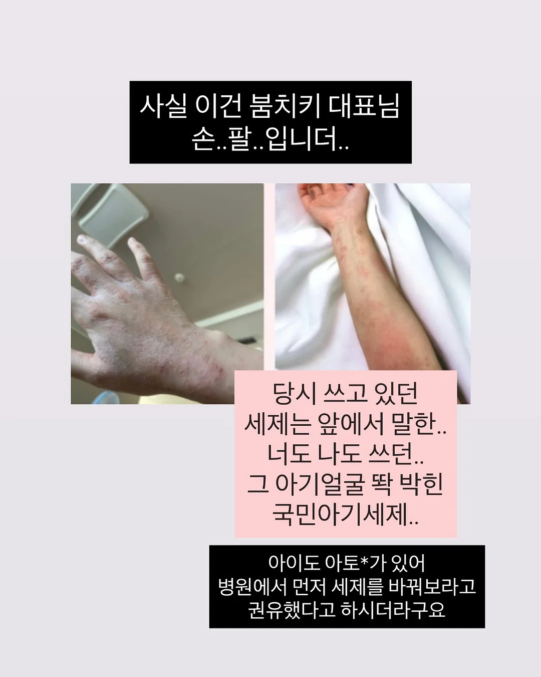 키에라 4
