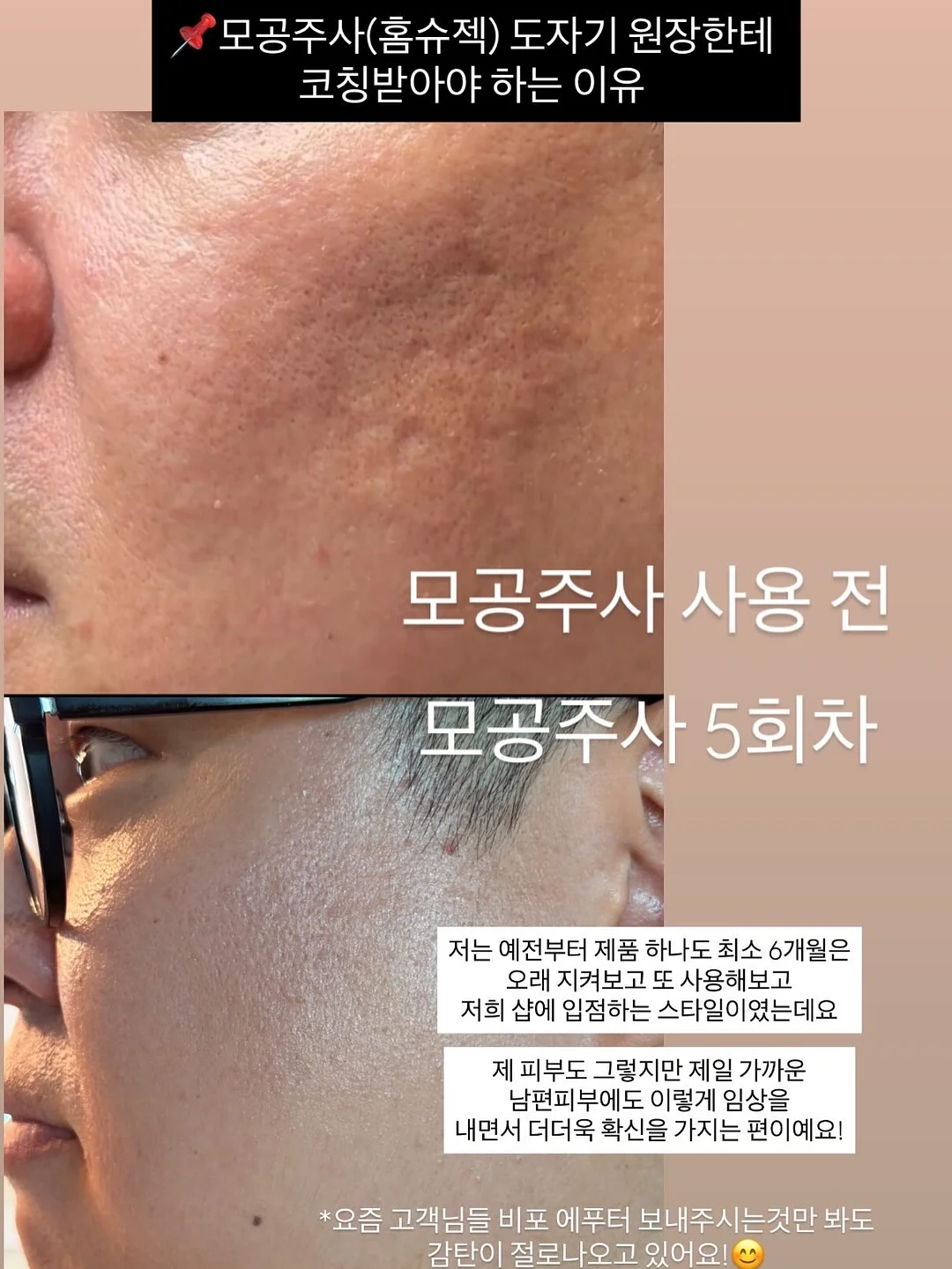 존쿡 델리미트 킬바사 8