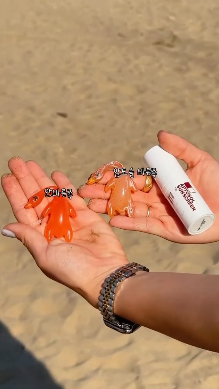 MCT 메타셀 줄기세포 시술