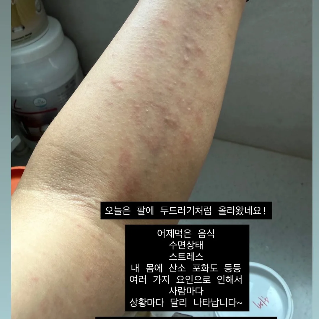 페린 수분앰플 6