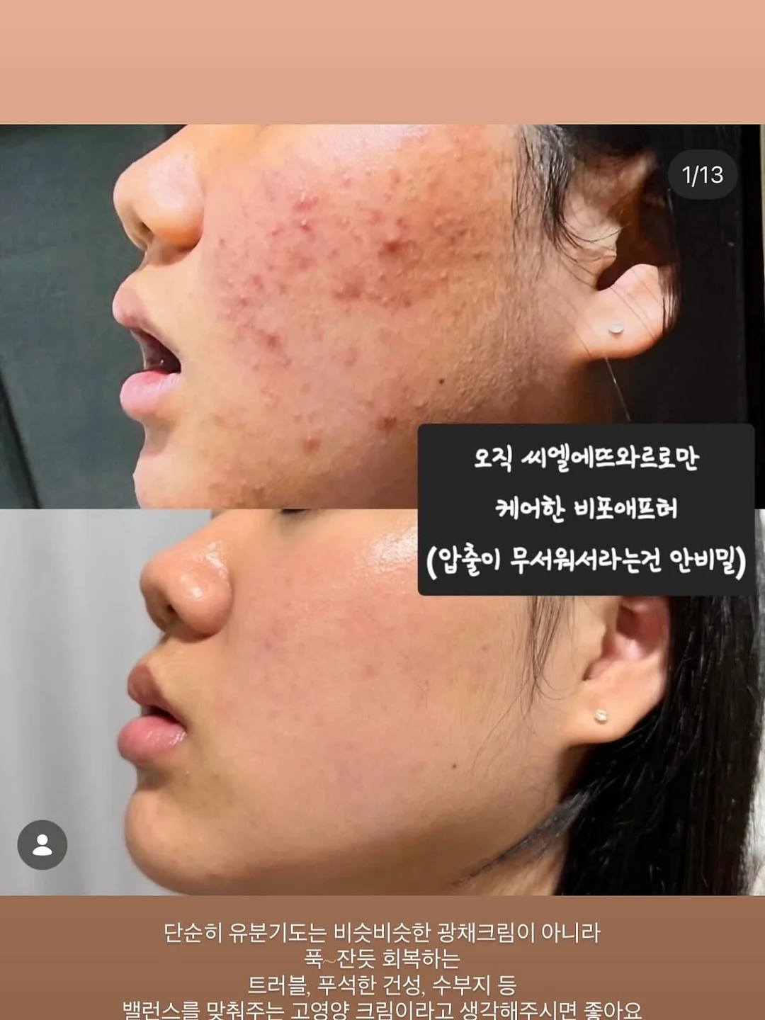 민턴 키캡 14