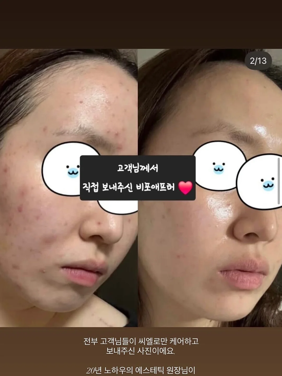 민턴 키캡 15