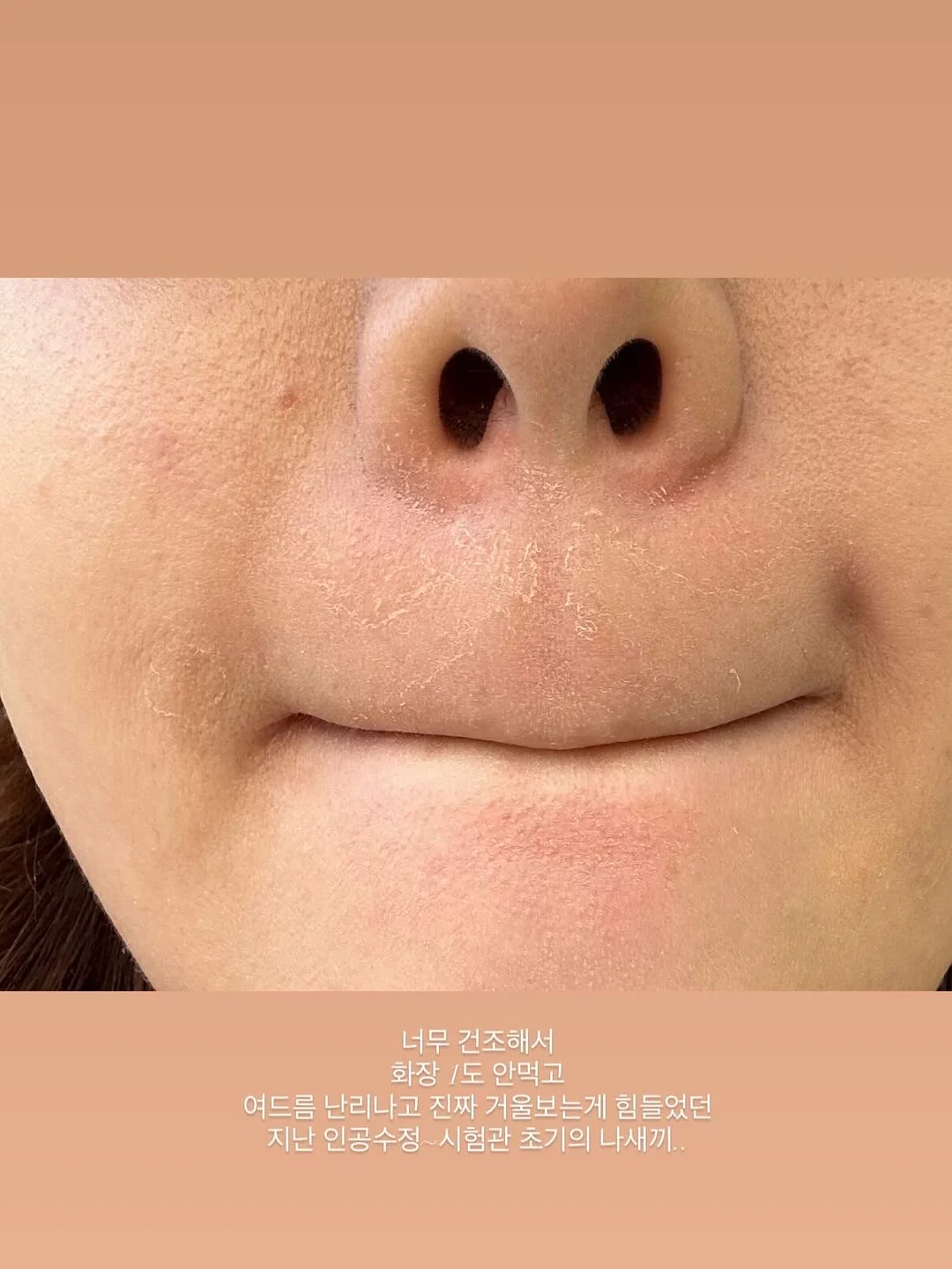 민턴 키캡 4
