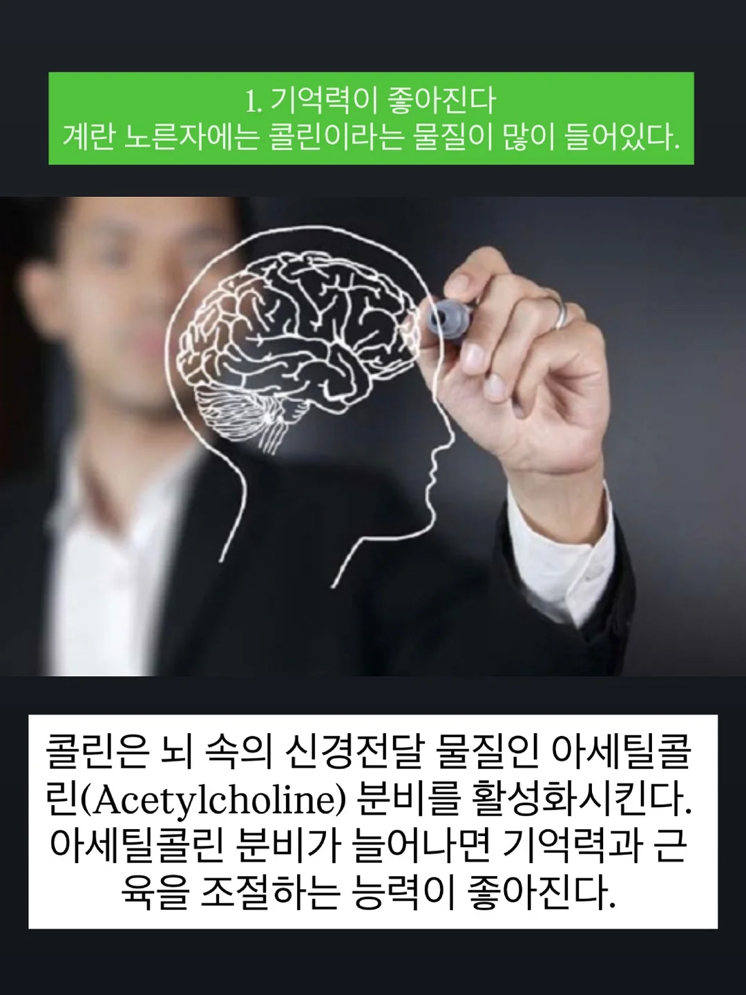 밀레 아동복 세트 3