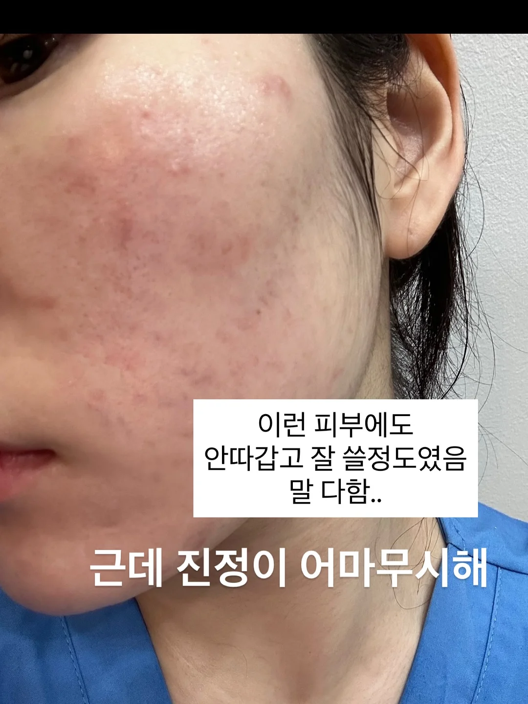 플랜티 스커트 6
