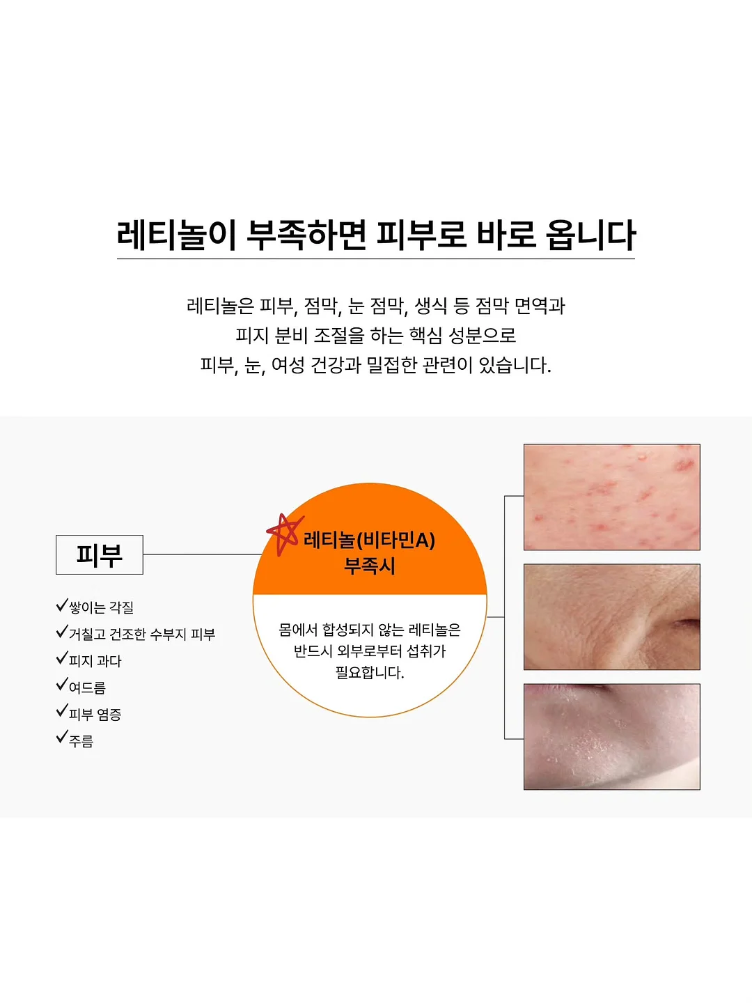 폴로 랄프로렌 린넨 셔츠 14