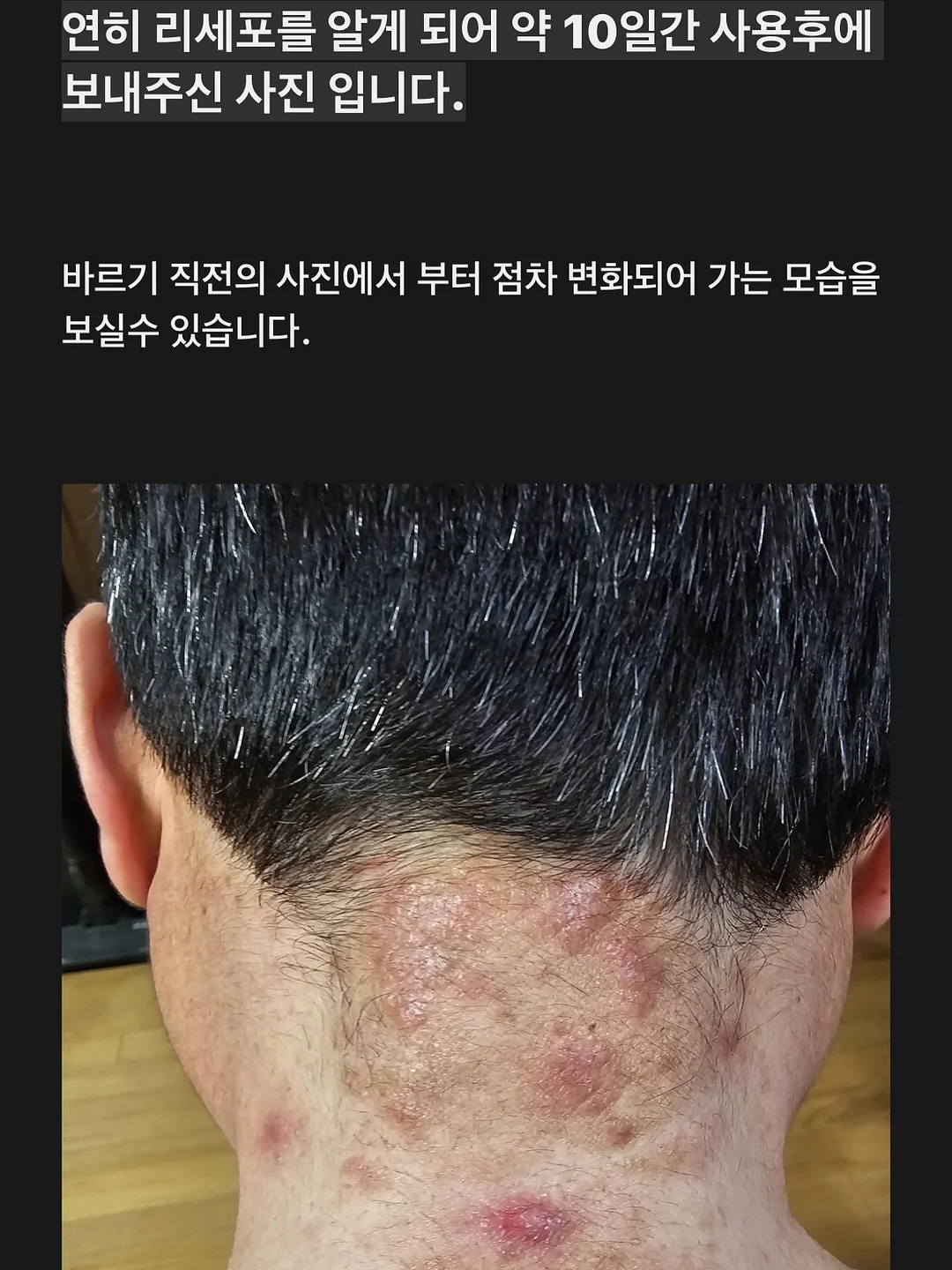 슈링클스 만들기 키트 16