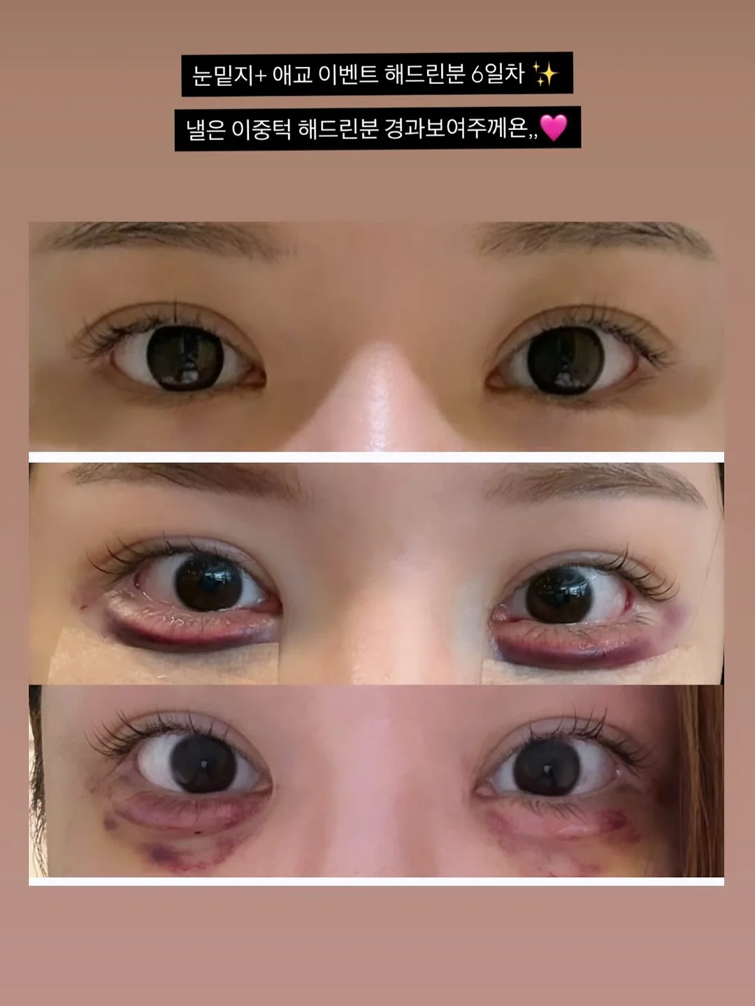 랑포켓바지 1