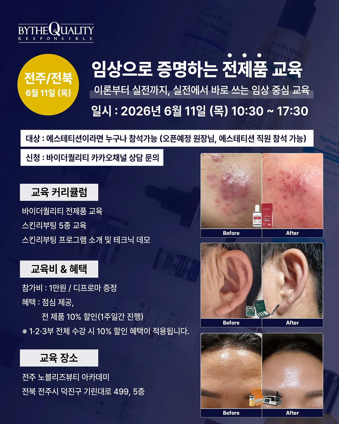 세탁기 클리너 1