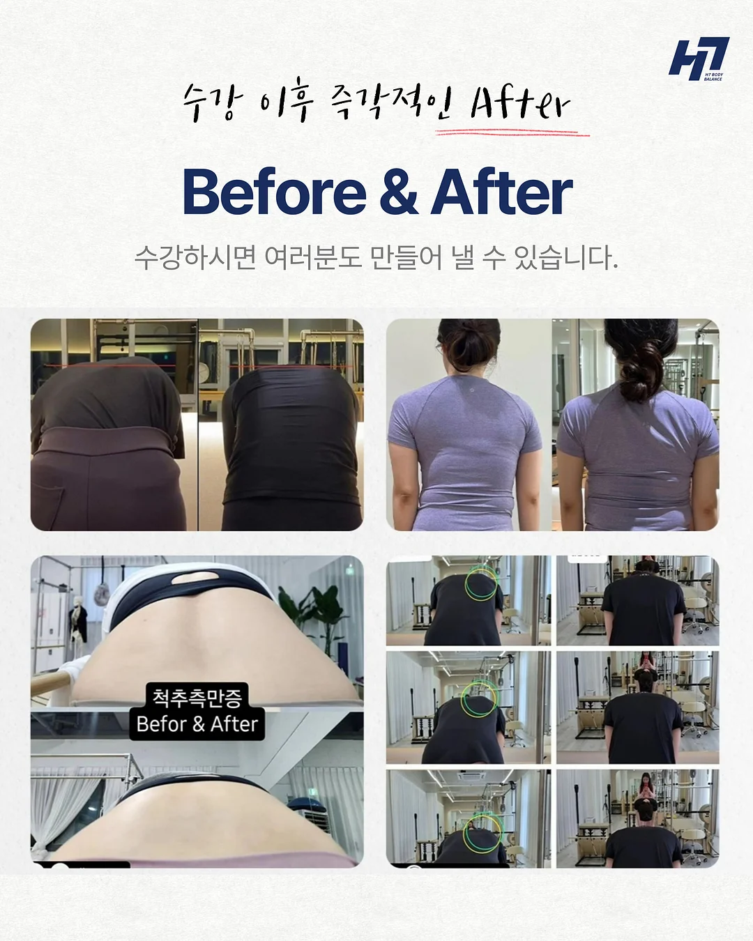 비스코아노락jp 바람막이 5