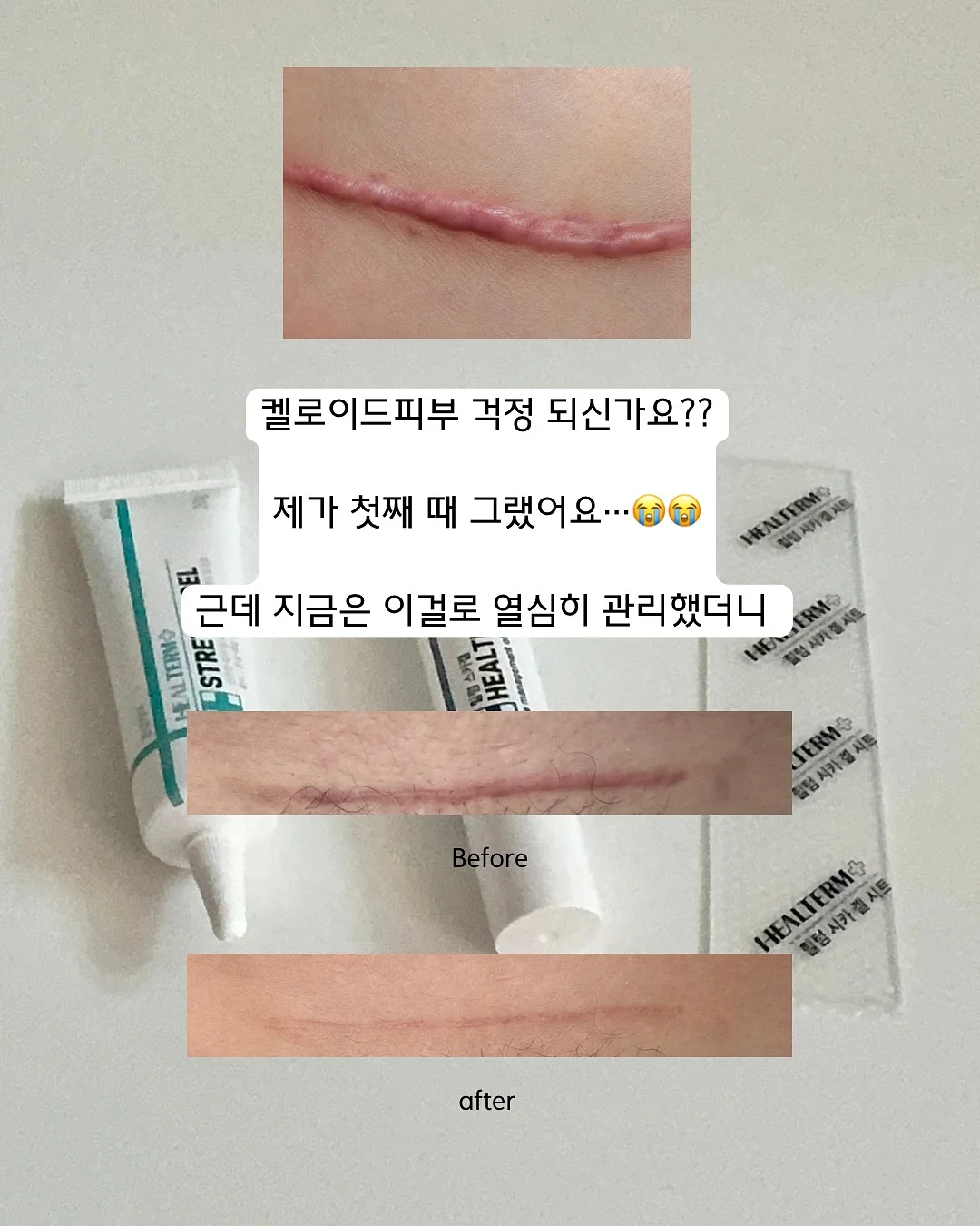 방충망 의자 4