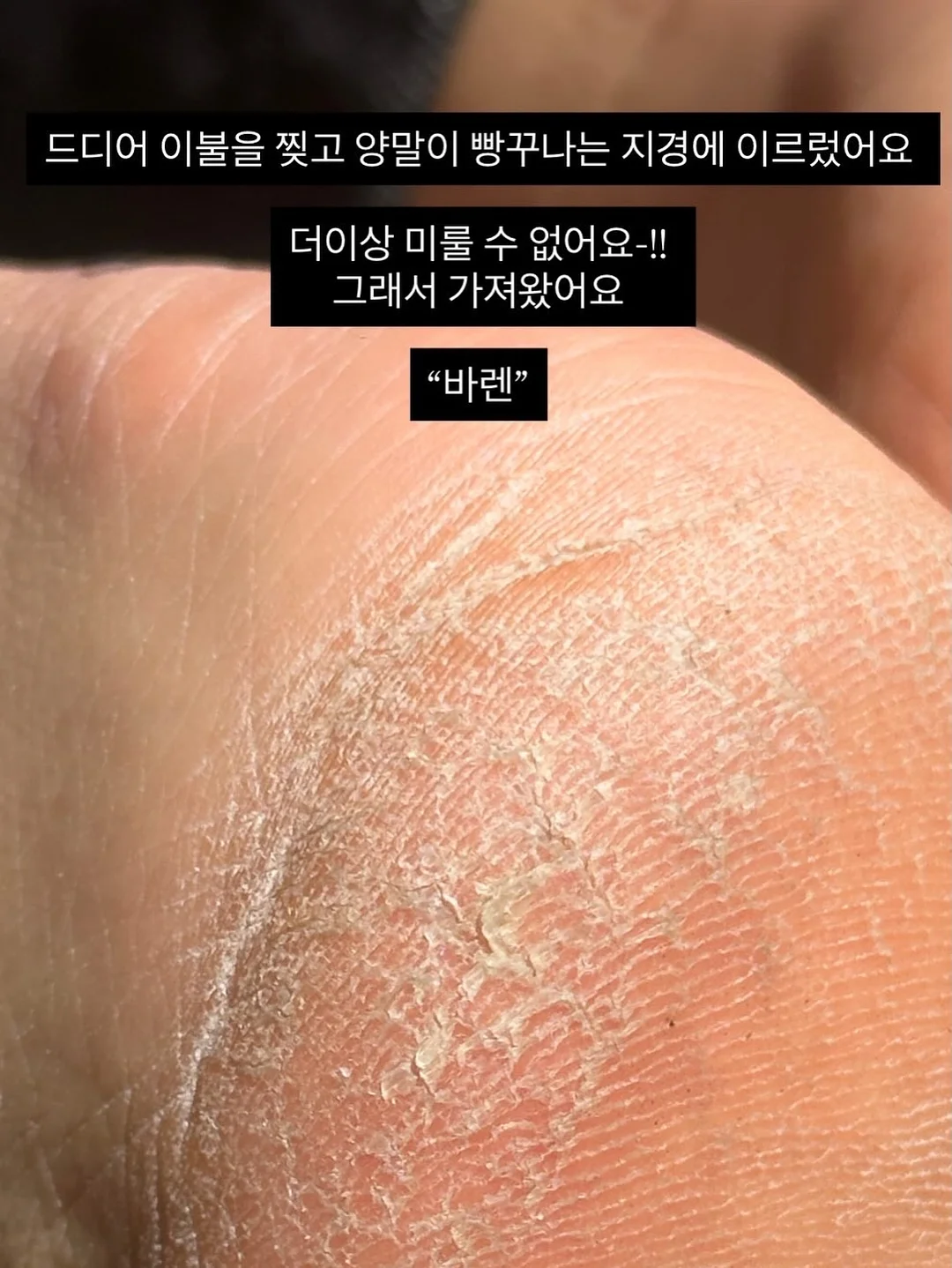 수국 플라워 케이크 / 그리너리 스웨그 2
