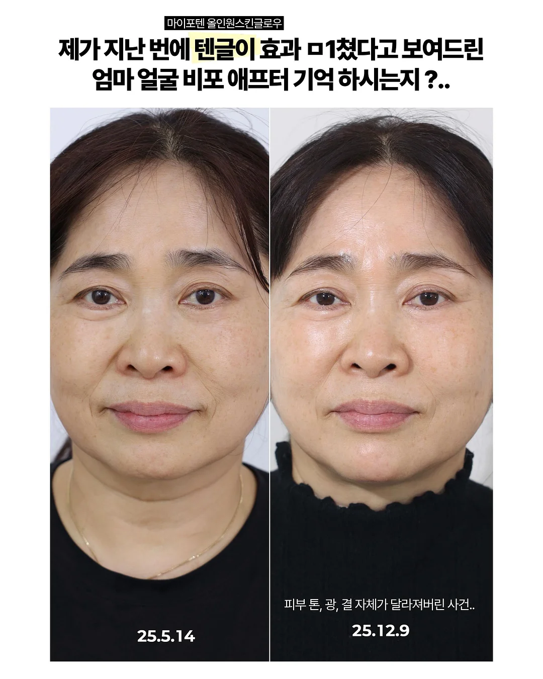생크림 케이크 2