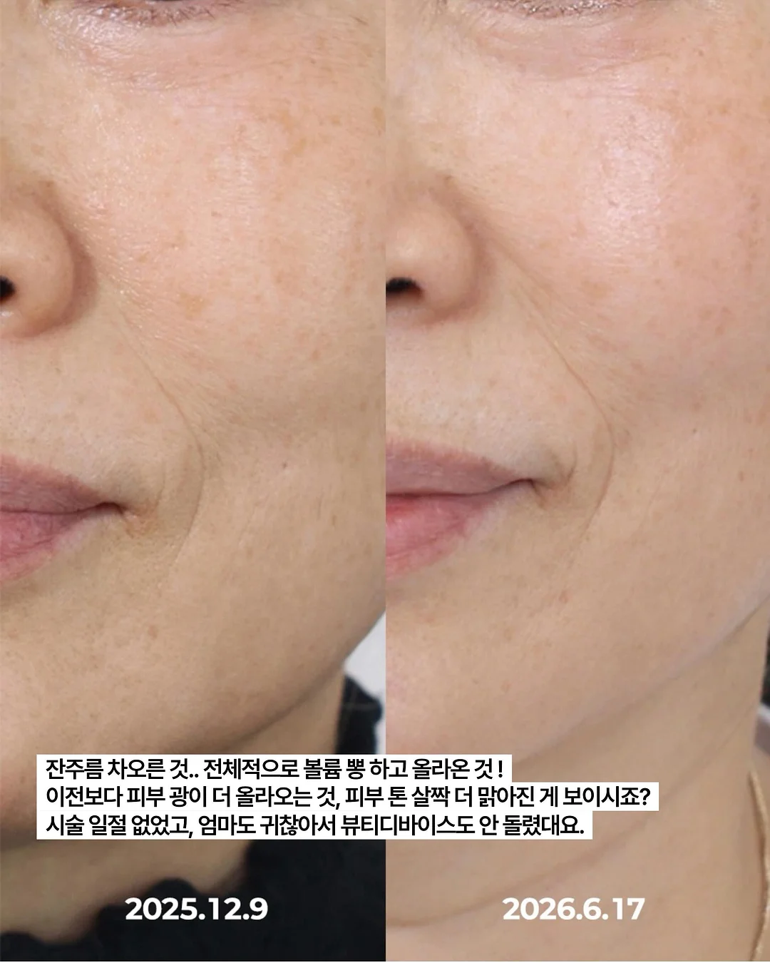 생크림 케이크 4