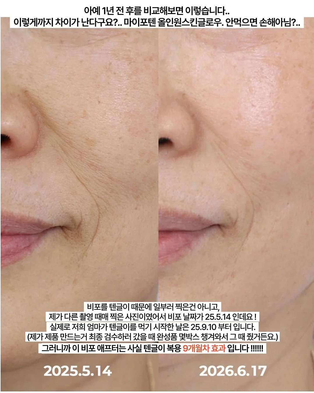 생크림 케이크 5