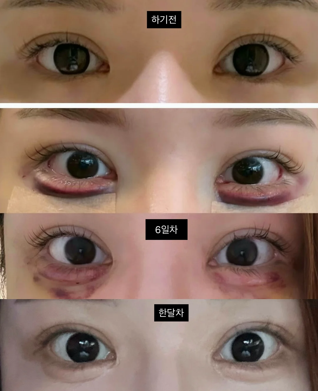 제너렉스 더마톡스 앰플 1