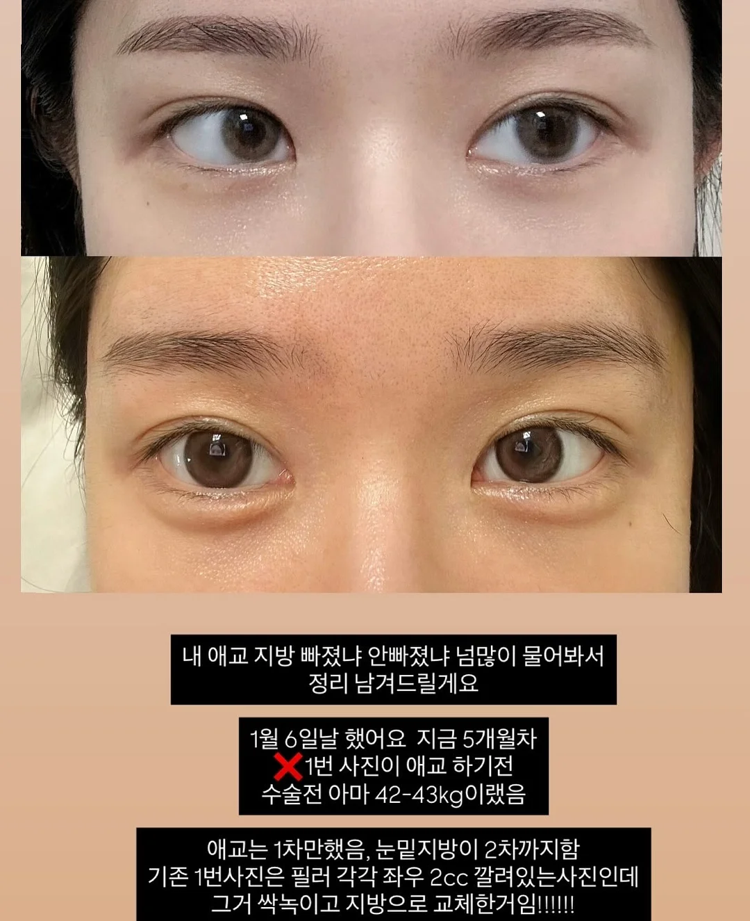 제너렉스 더마톡스 앰플 2