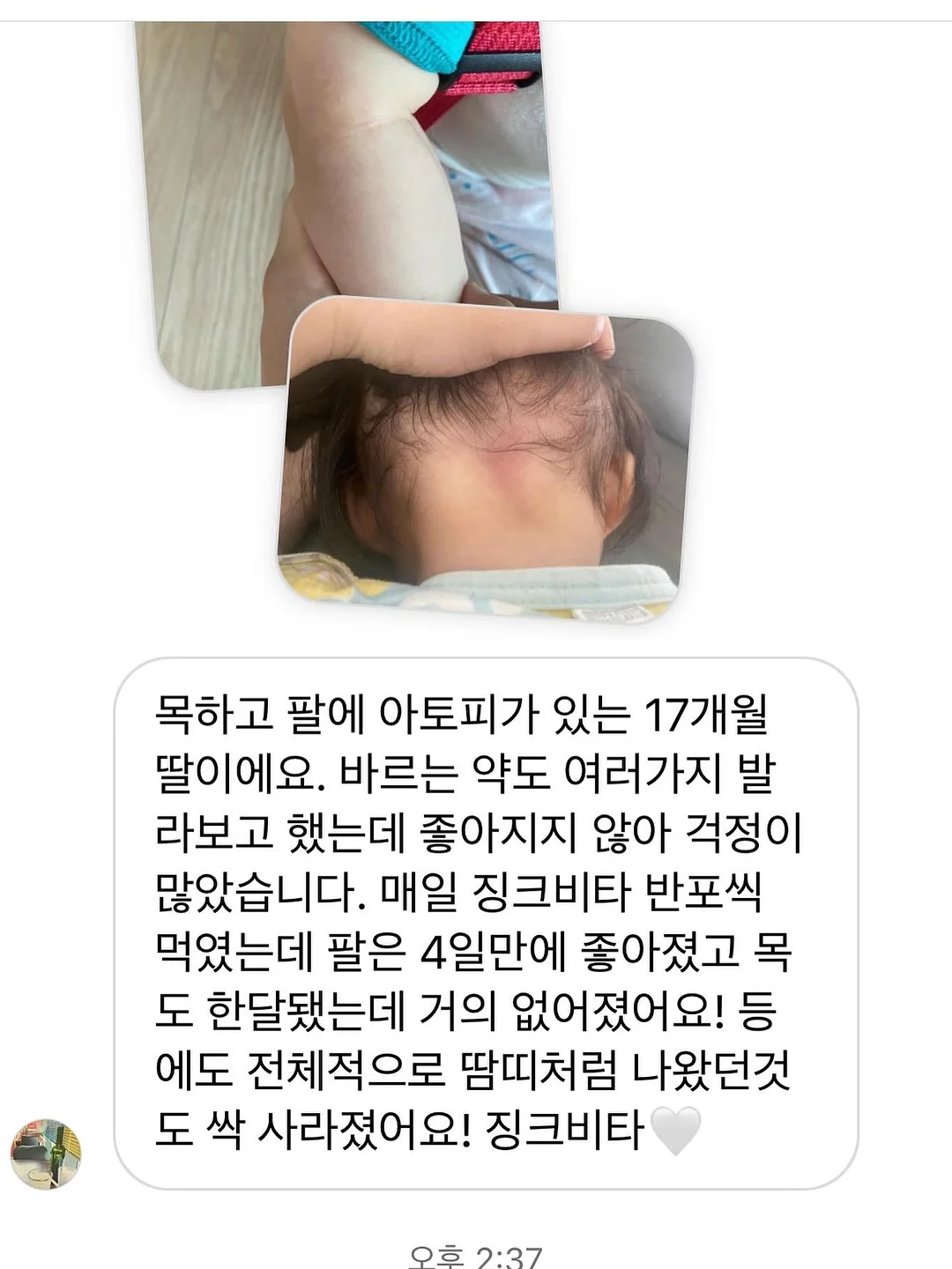 실버 반지 5
