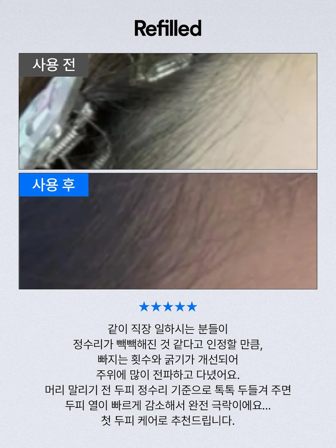 클로버 써지컬 목걸이 13