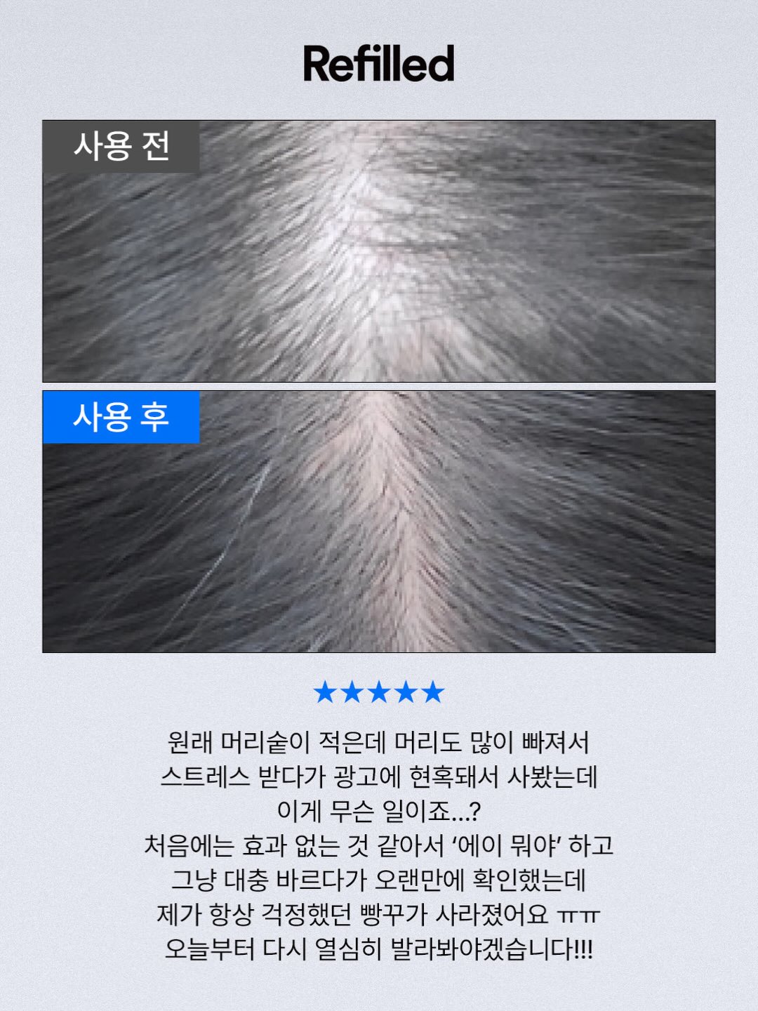 클로버 써지컬 목걸이 14