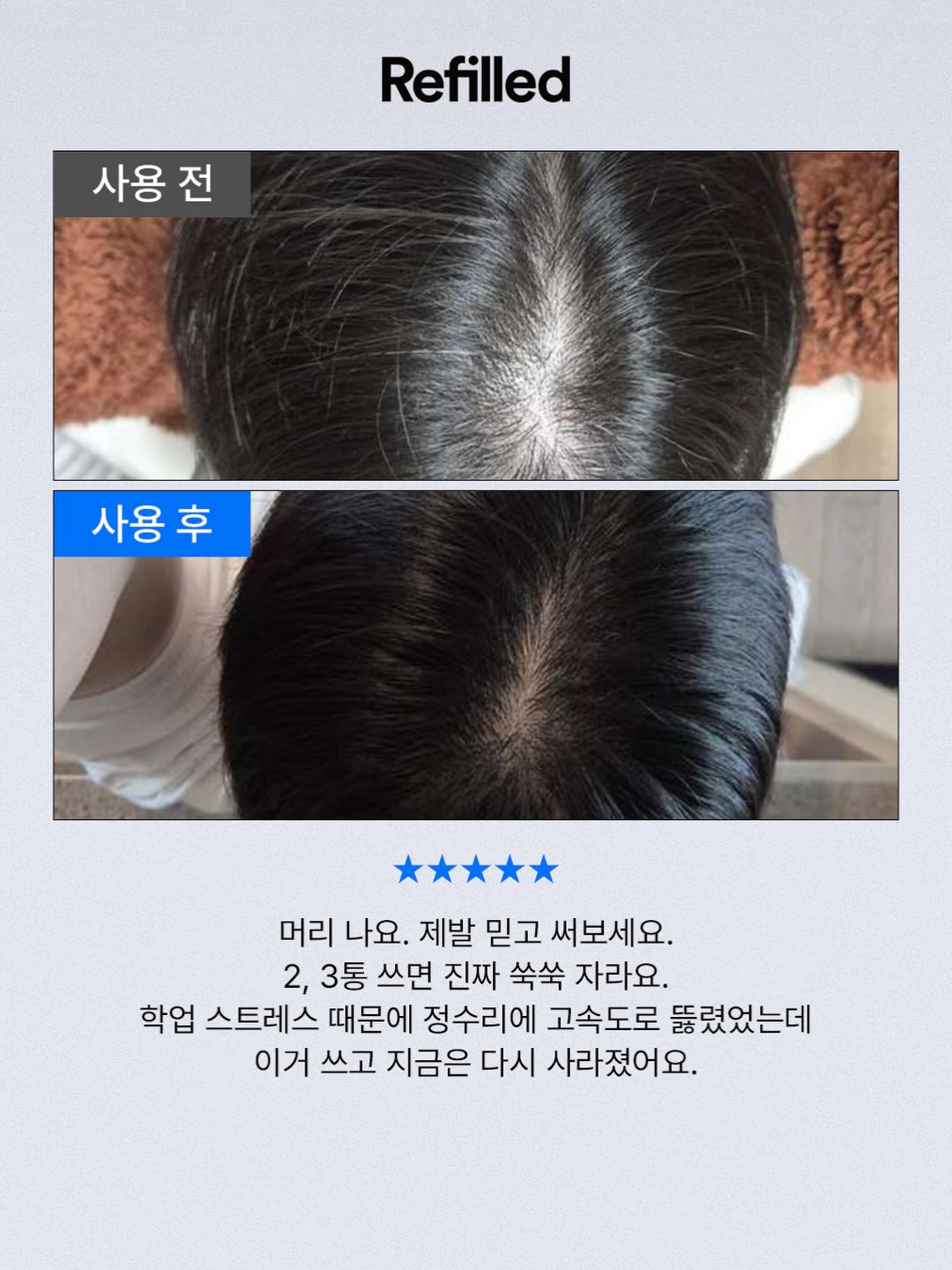 클로버 써지컬 목걸이 15