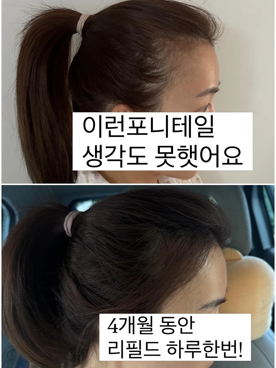 클로버 써지컬 목걸이 3