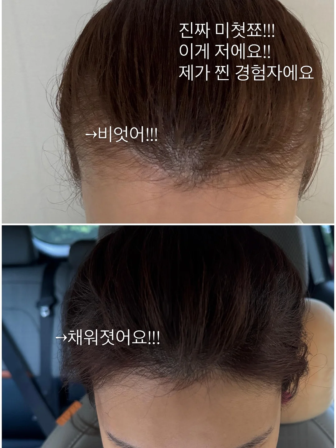 클로버 써지컬 목걸이 4