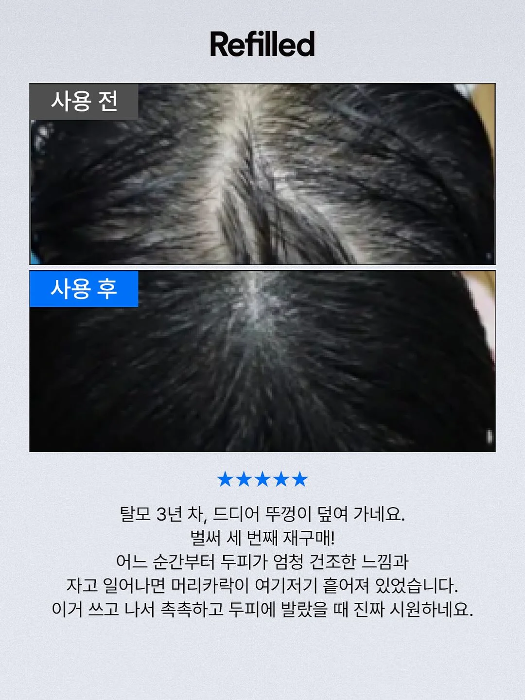 클로버 써지컬 목걸이 9