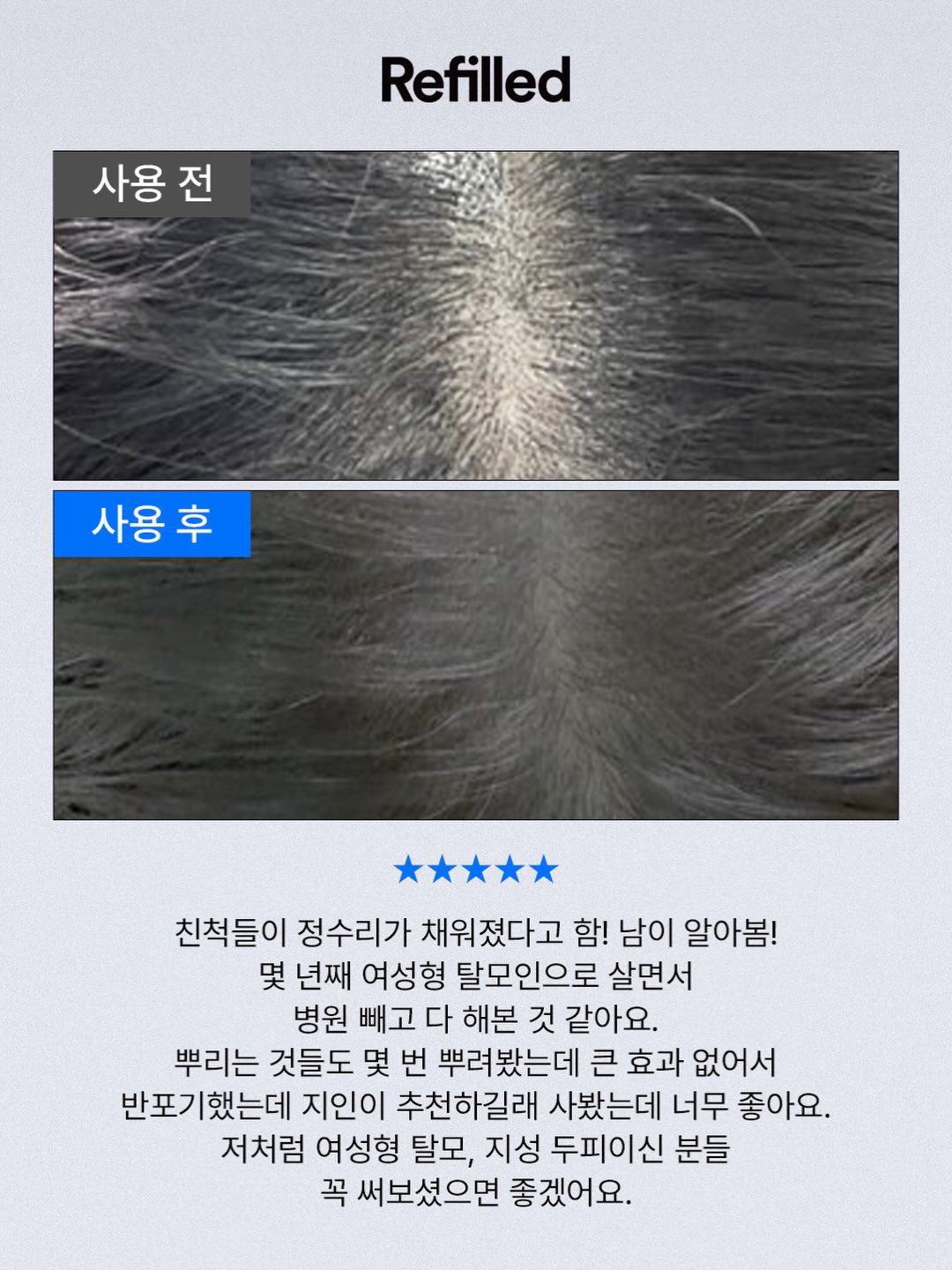 클로버 써지컬 목걸이 10