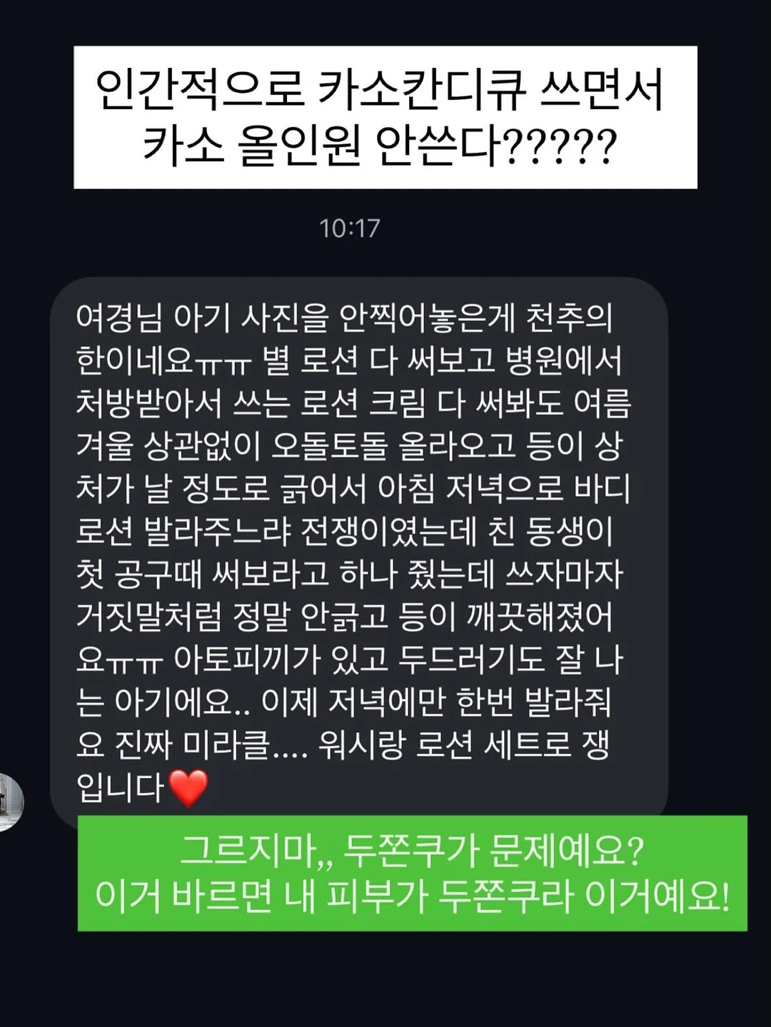 와플스커트 11
