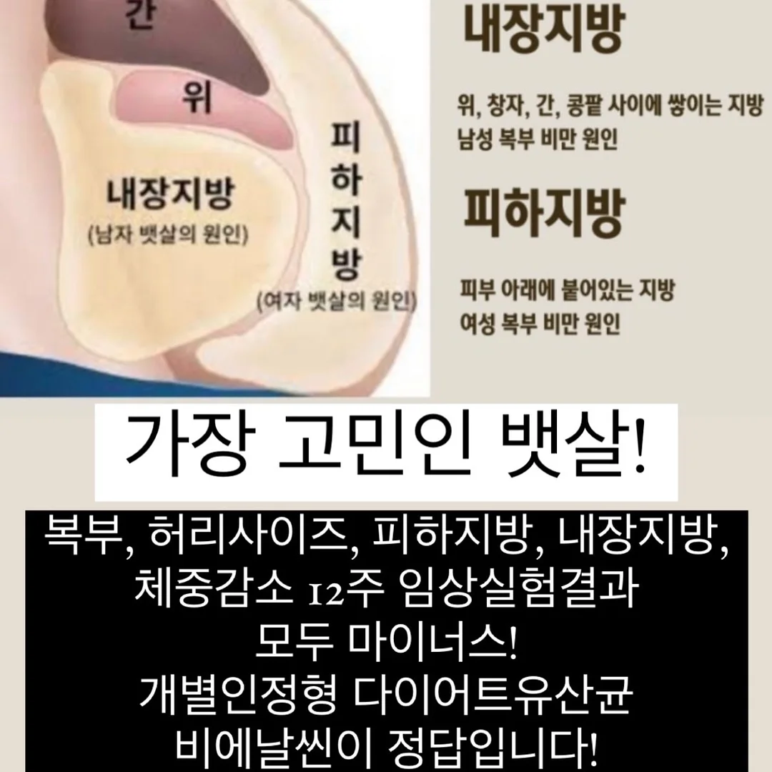 우영미 튤립 블랙 반팔 2