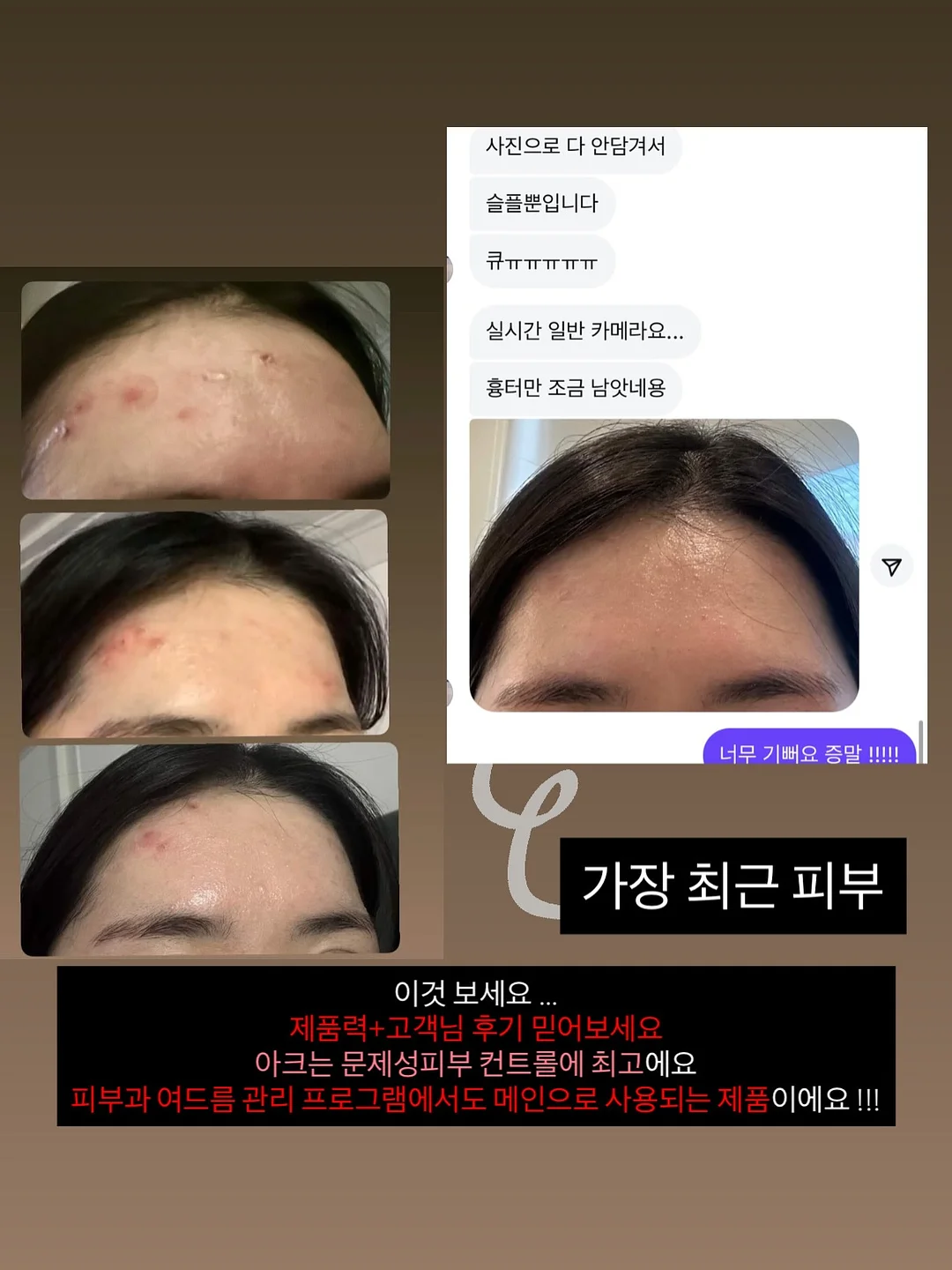 서볼 전제품 1