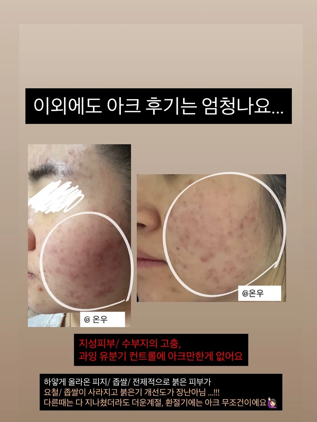 서볼 전제품 2