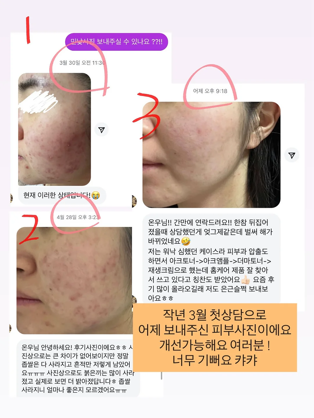서볼 전제품 3