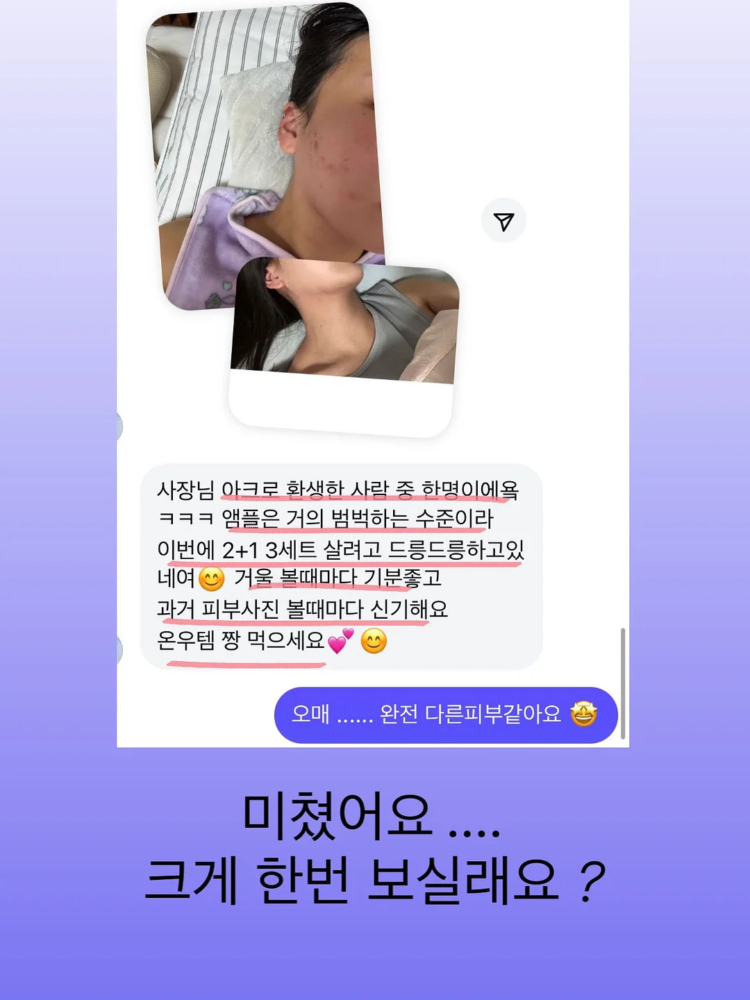 서볼 전제품 4