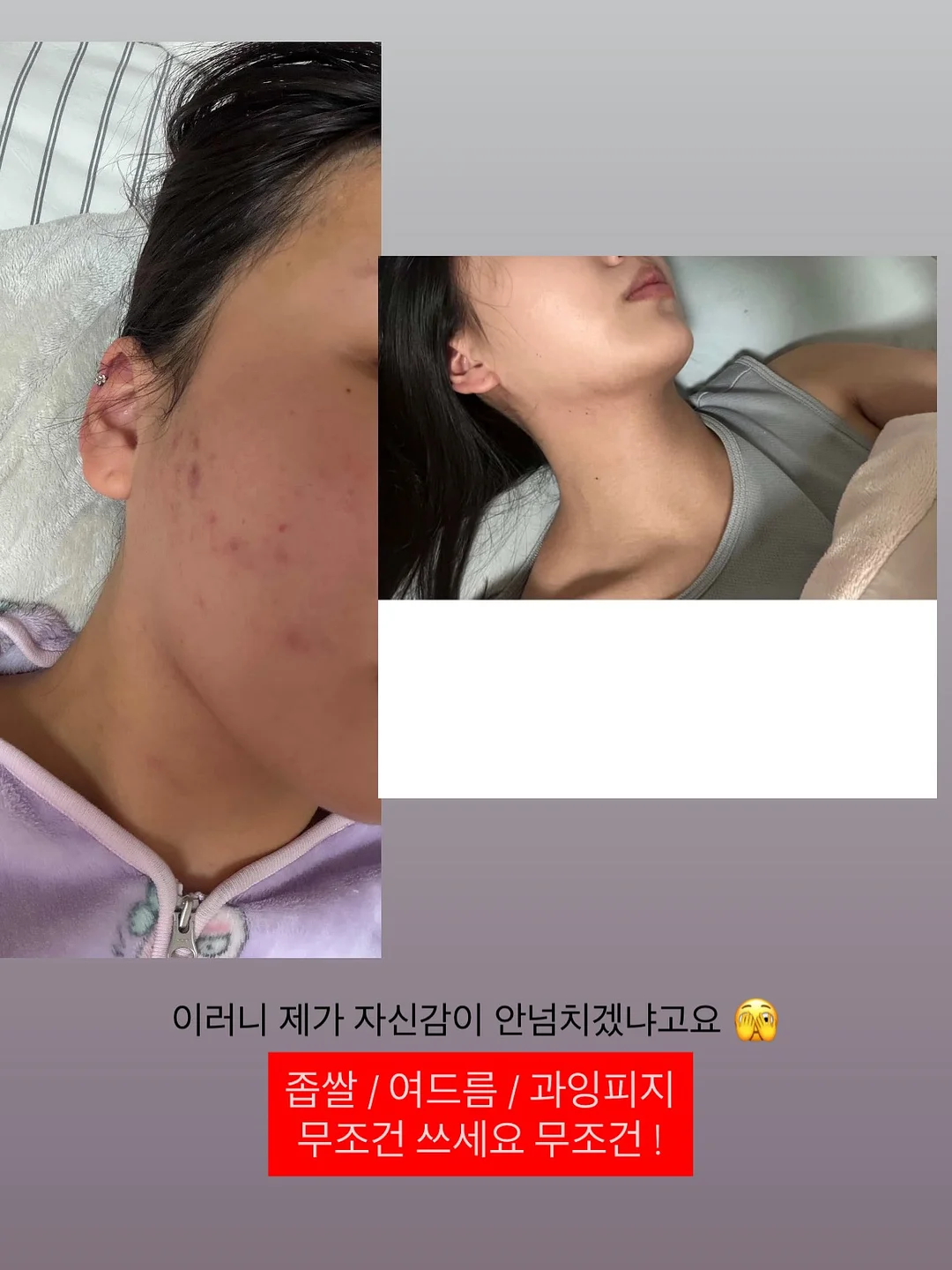서볼 전제품 5