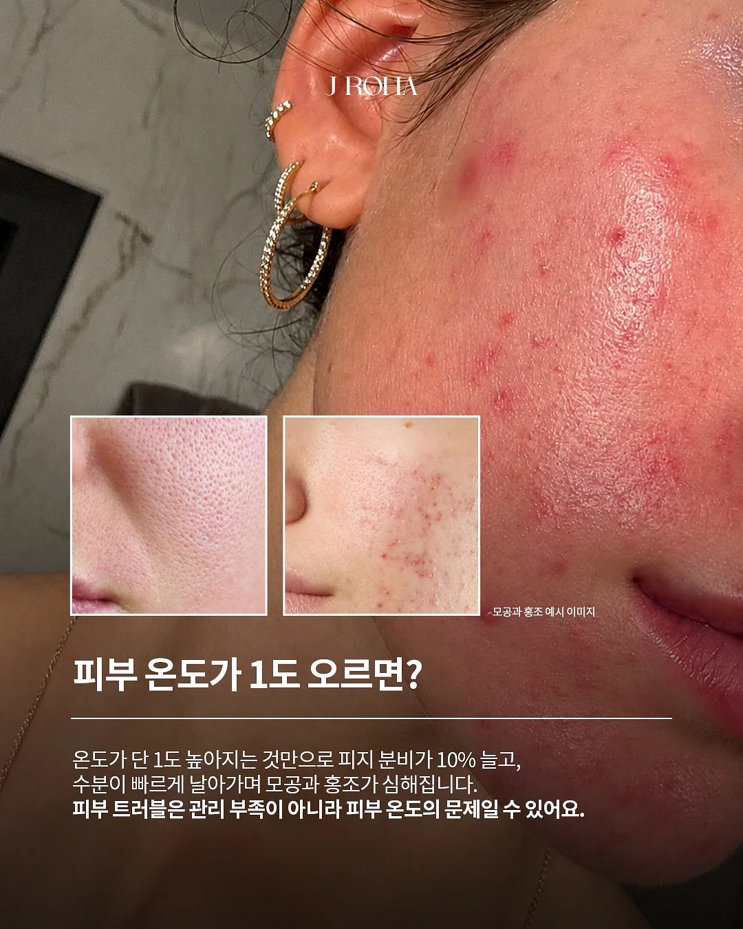 아추추 수퍼쿨 냉감베딩 2