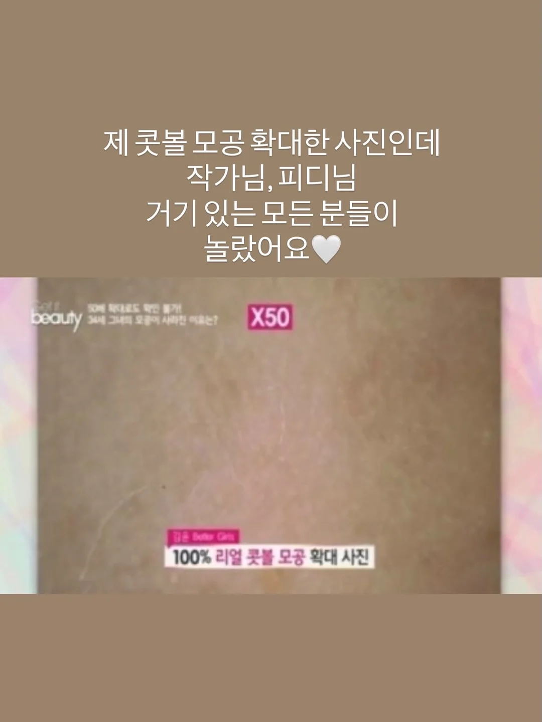 실버 네트백 만들기 키트 9