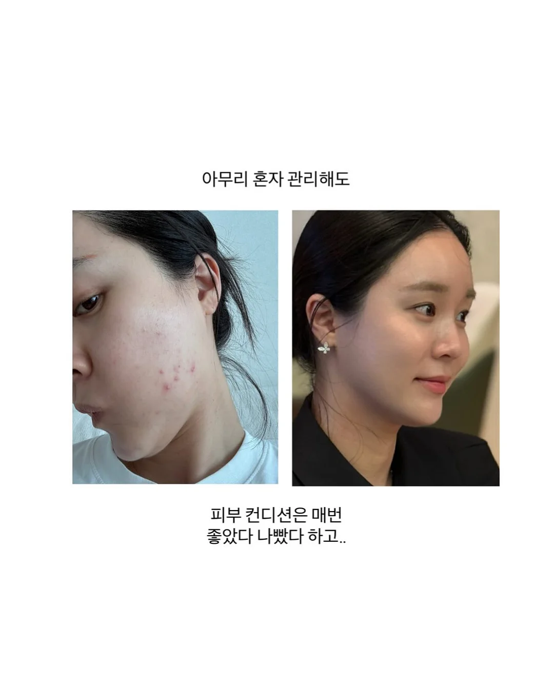 클렌즈 주스 2