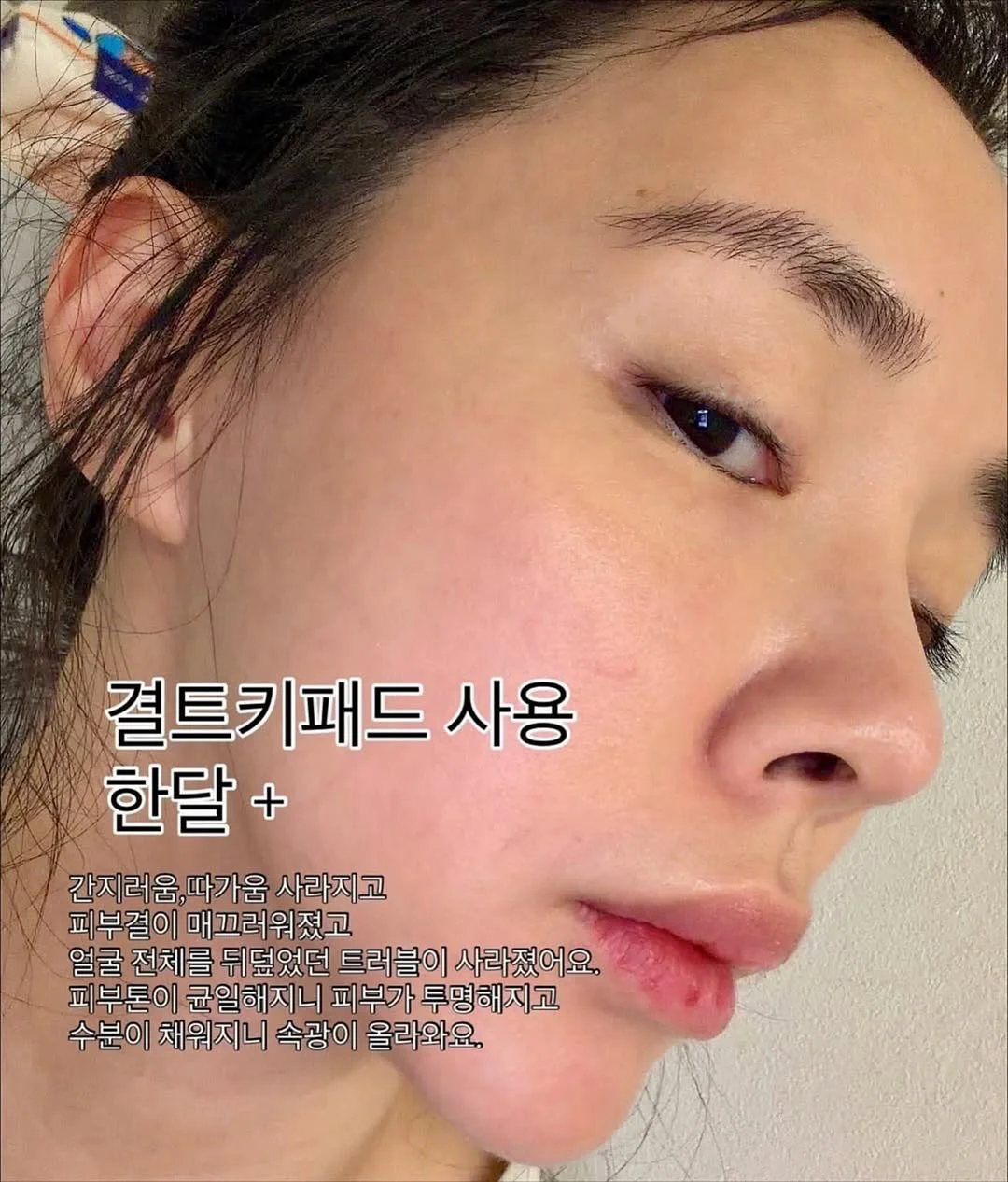 심바바이오 디데일리 유산균 1