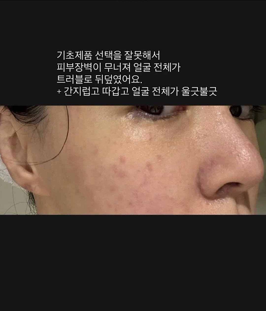 심바바이오 디데일리 유산균 2