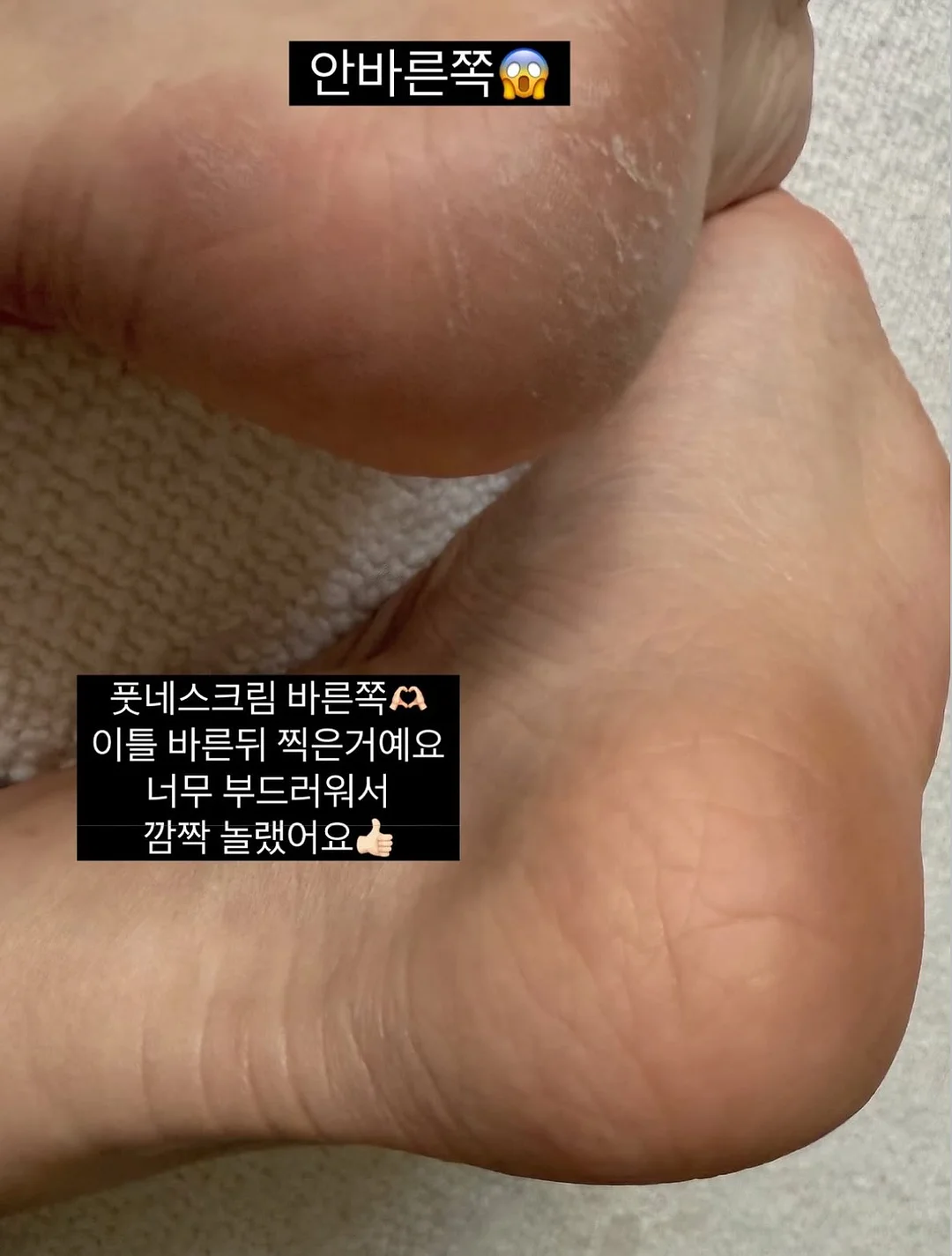 귀멸의 칼날 오네무탄 스페셜 리믹스 4탄 가챠 2
