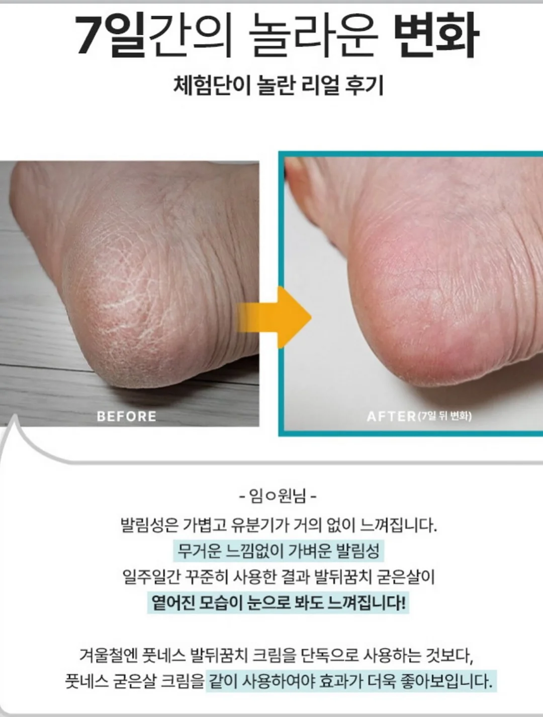 귀멸의 칼날 오네무탄 스페셜 리믹스 4탄 가챠 6