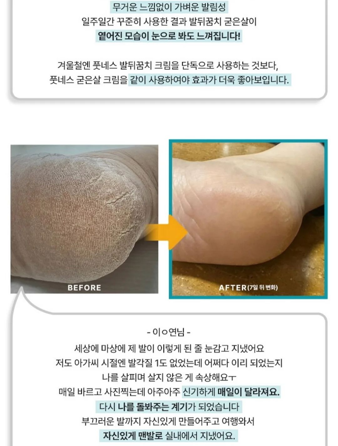 귀멸의 칼날 오네무탄 스페셜 리믹스 4탄 가챠 7