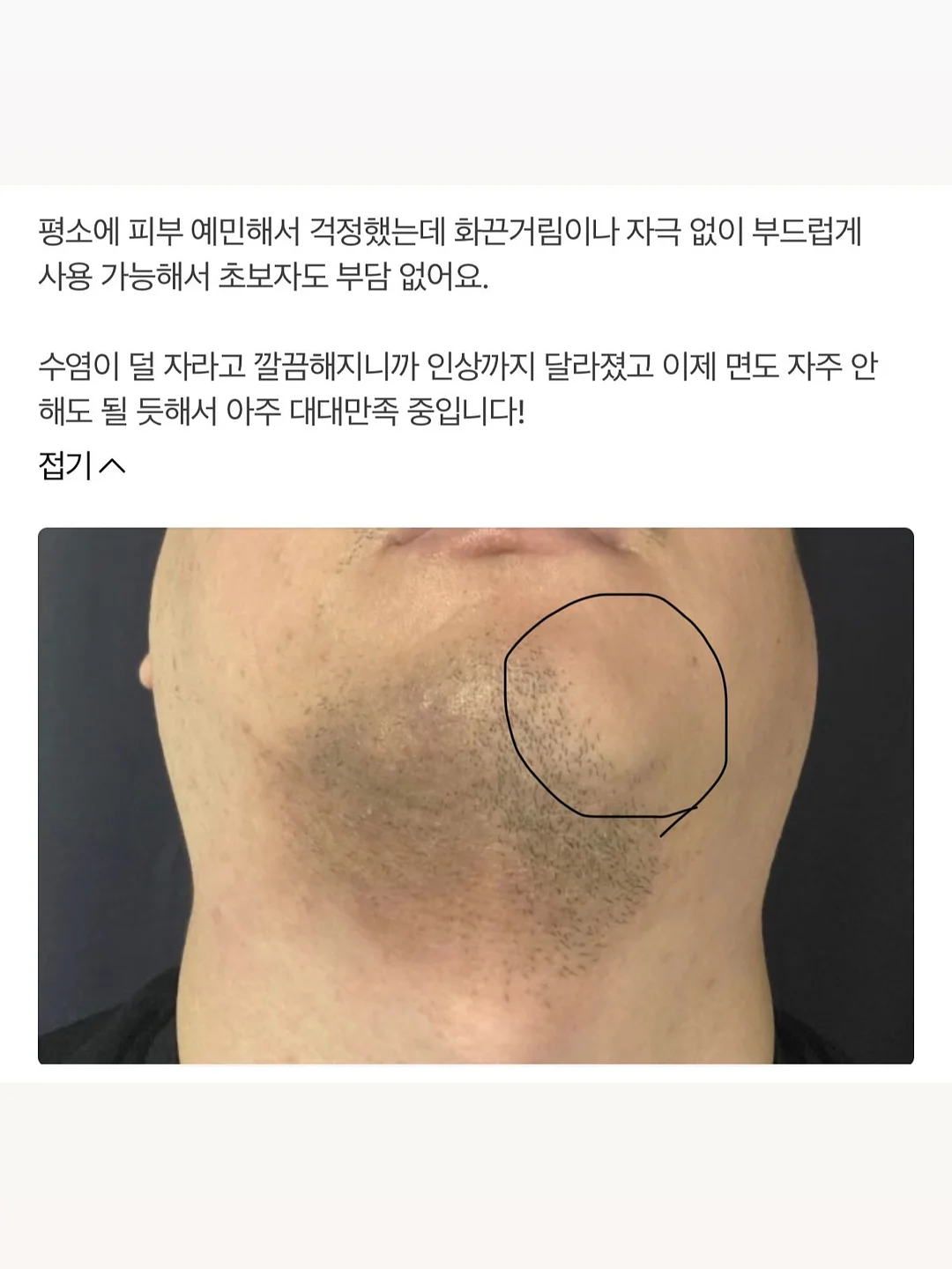 비치 롬퍼 10