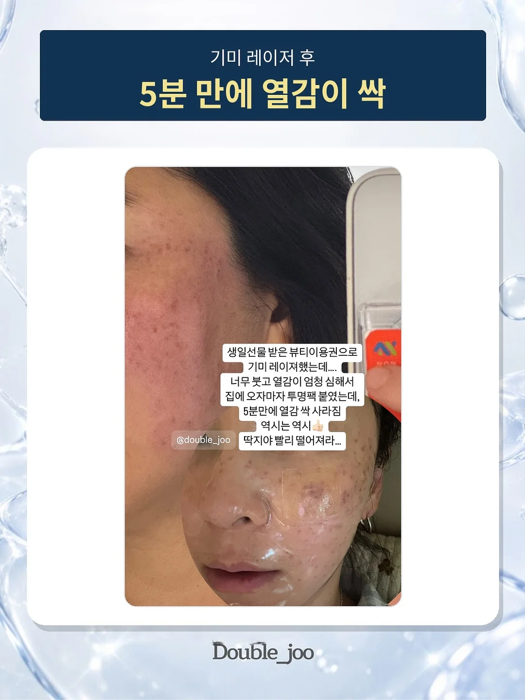 오즈모 포켓4 접이식 삼각대 11