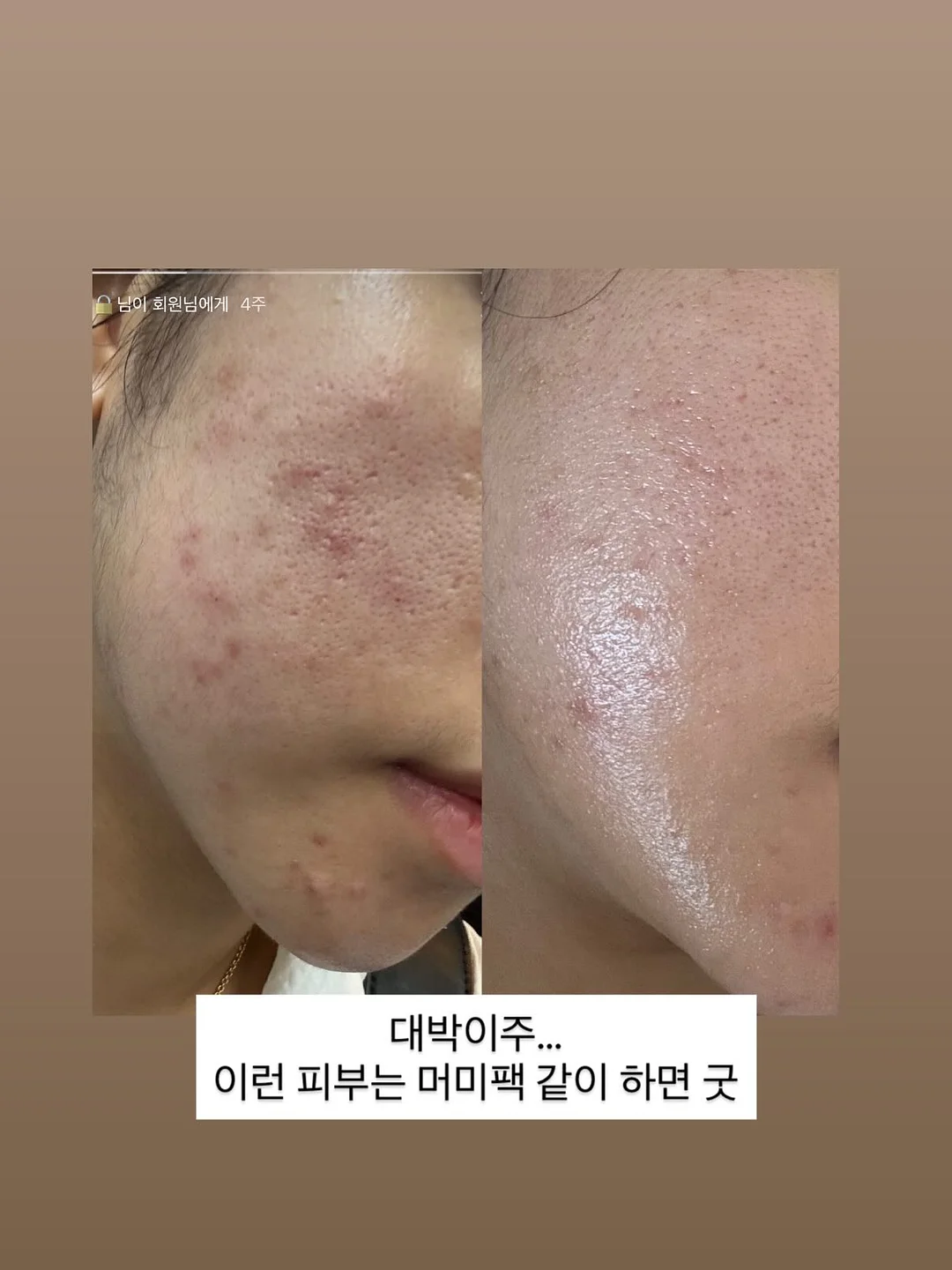 꼼데가르송 가디건 5