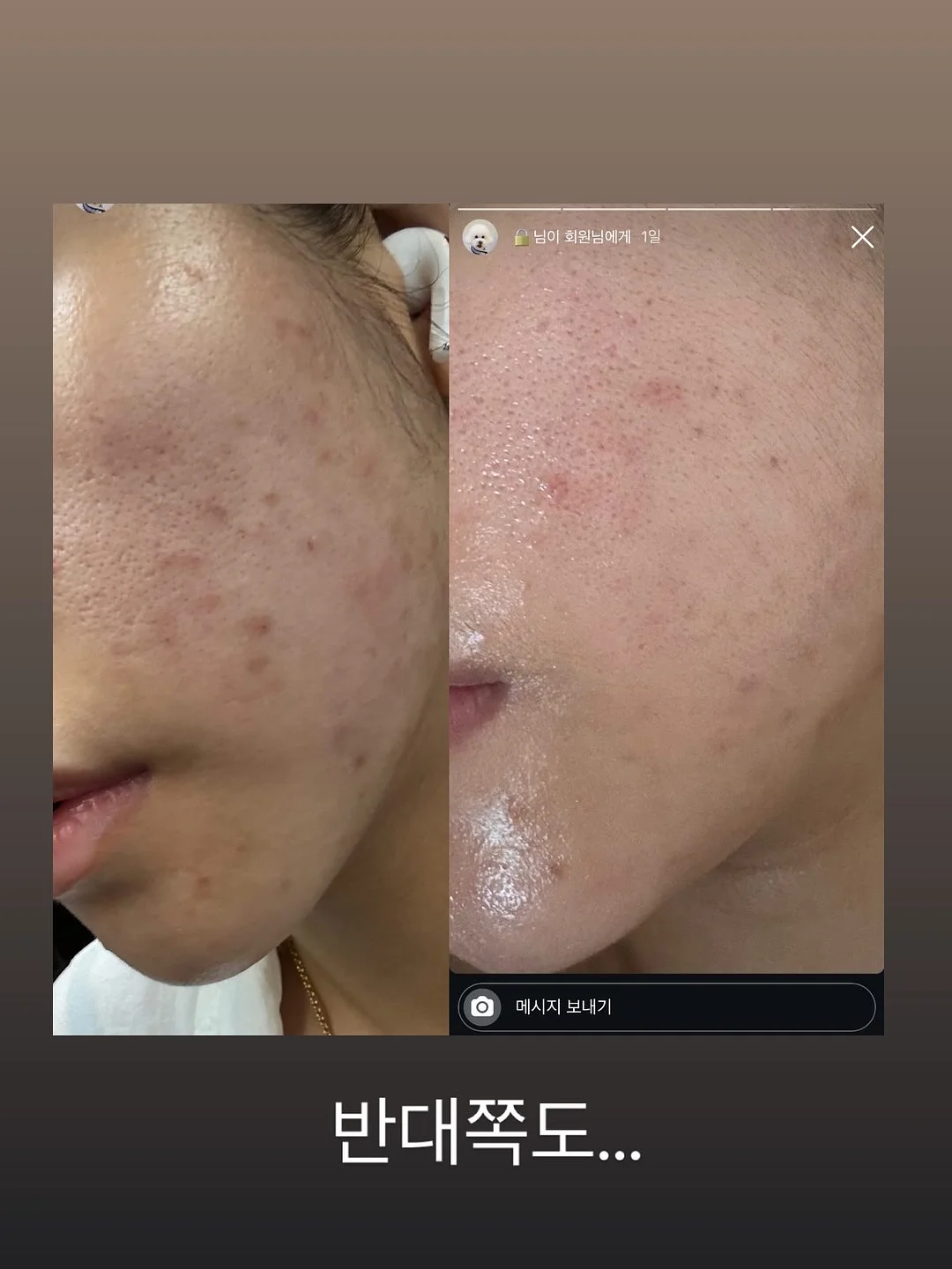 꼼데가르송 가디건 6