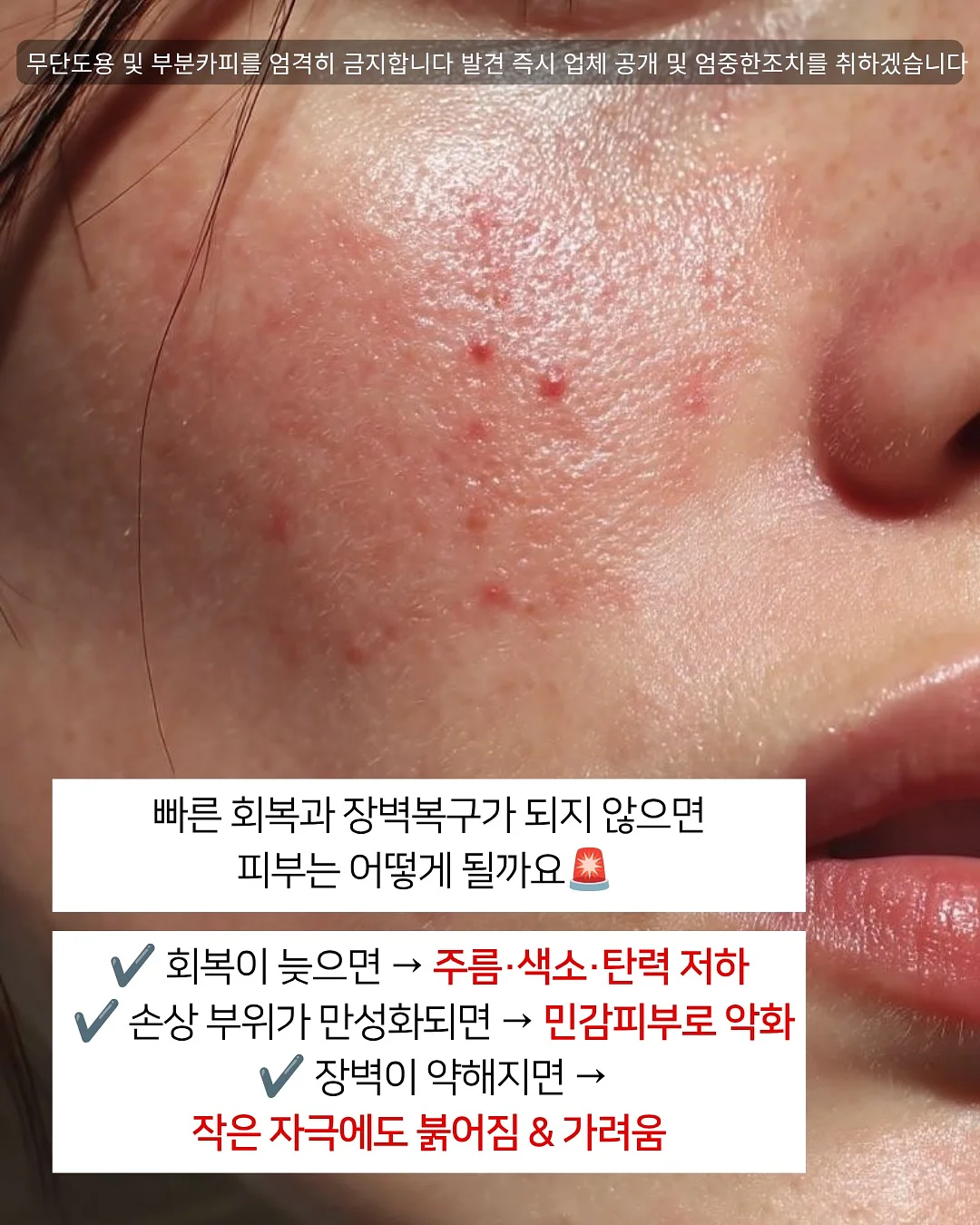 실크 자켓 2