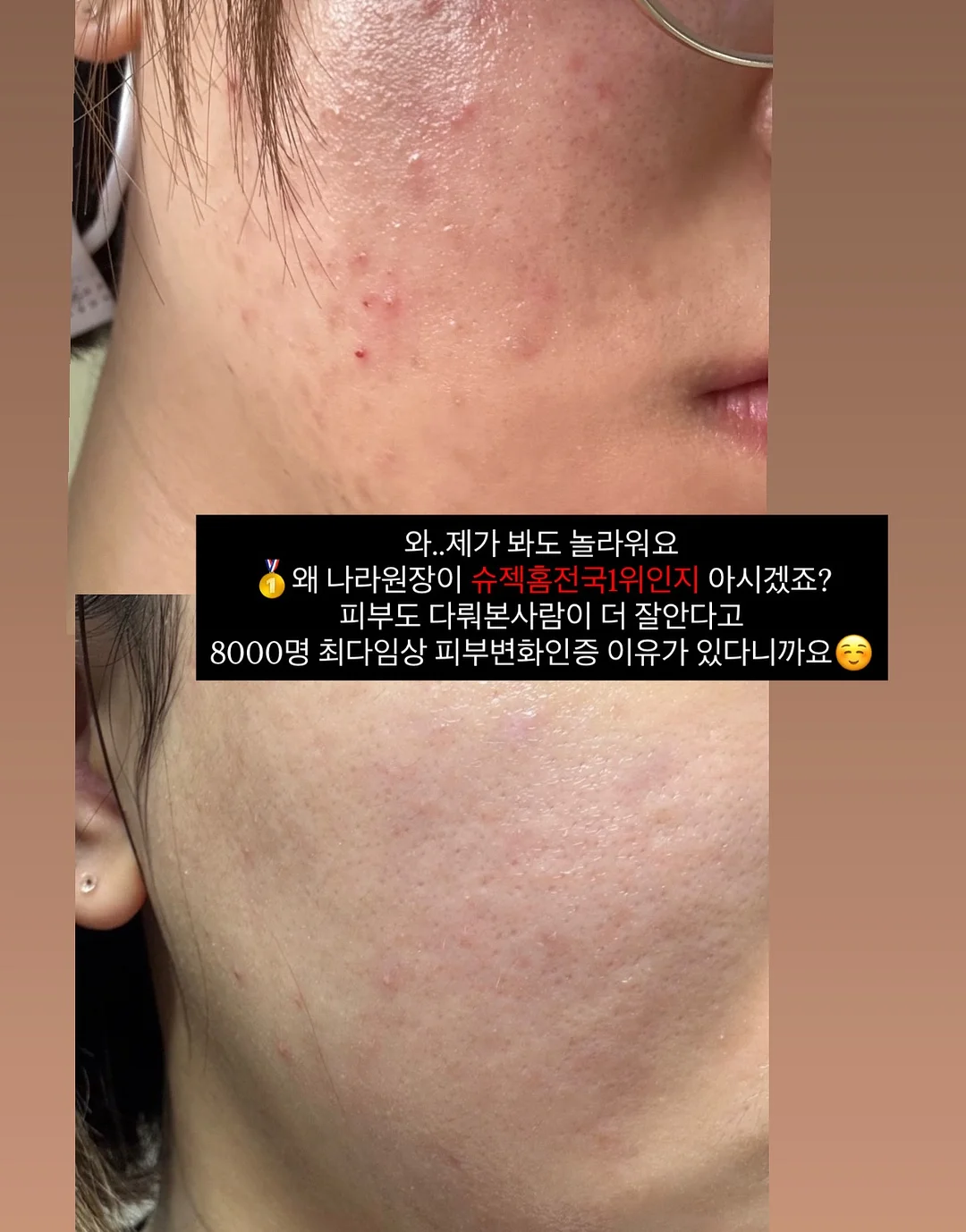 성인 플리츠 세트 11